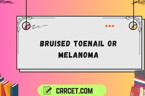 bruised toenail or melanoma